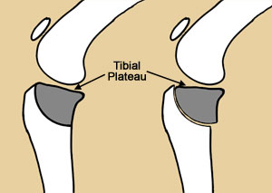 Tibial Plateau Leveling Osteotomy (or TPLO) Surgery